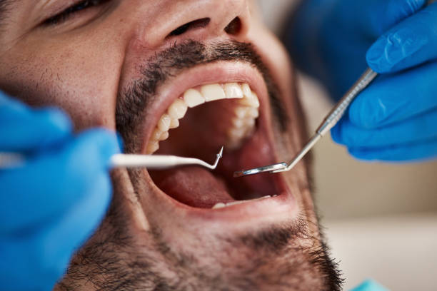 Best Emergency Dental Extractions in Athens, MI